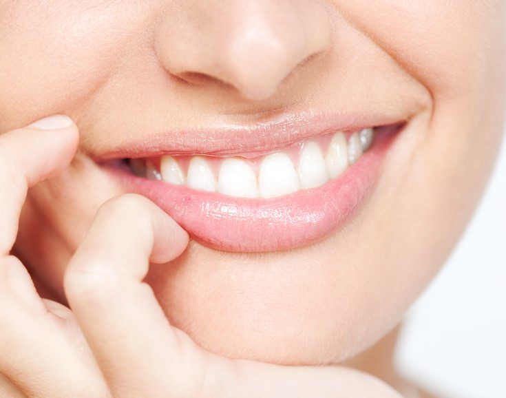 Tooth Whitening